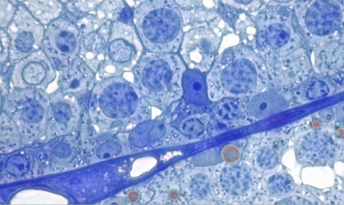 Male germ cells (Wellcome Images UK - CC-BY-NC-ND)