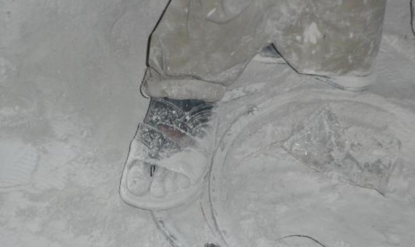 Pied d’un ouvrier de pierres précieuses, couvert de poussière de silice